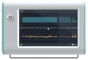 BAYOOCARE - NeoDoppler CIMON Medical-3 Der NeoDoppler misst den Hirnblutfluss bei Frühgeburten kontinuierlich, die in den ersten Lebensmonaten einem erhöhten Risiko von Hirnschäden unterliegen.